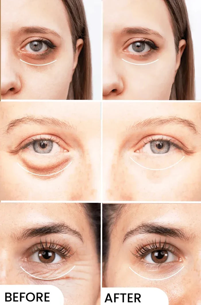 Eyelight Pack of 3 - Eliminates Dark Circles
