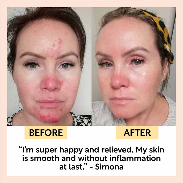 Night cream with hyaluronic acid + niacinamide - Travel size