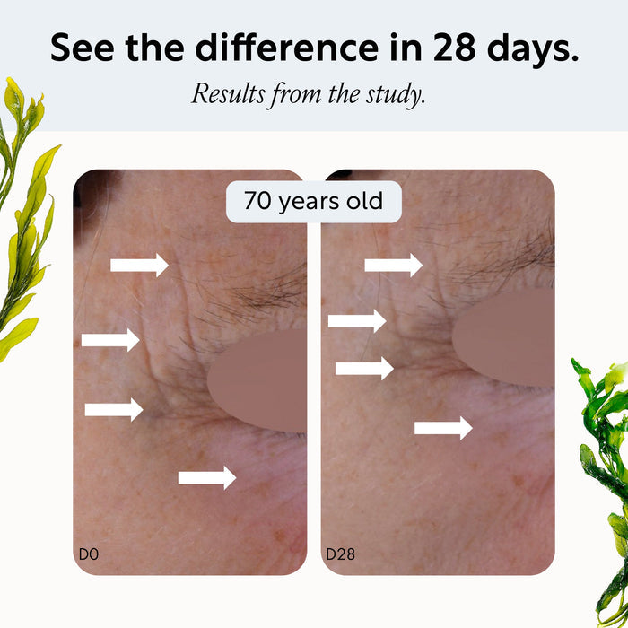 Overnight Eye Treatment With Retinol Exosomes